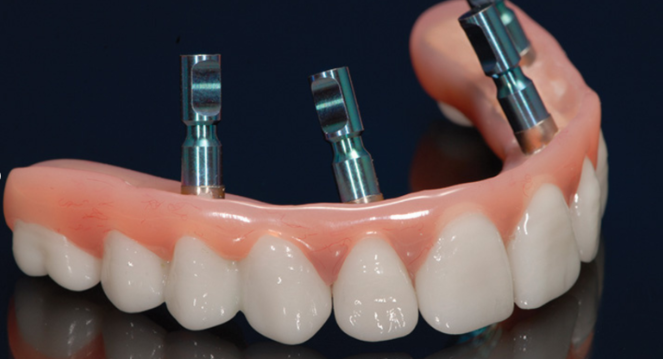 Example of Zirconia Dental Implants.
