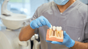 Dentist showing examples of dental implants