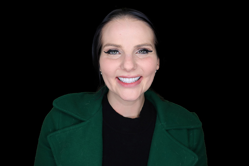 Katie Feuerbach Teeth After Dental Implant