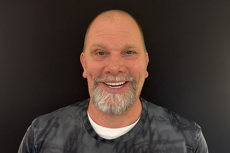 After Dental Implants